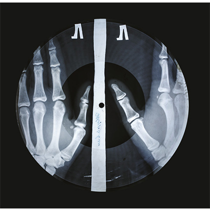 View full size X Ray Audio